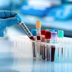 Lab Testing Near Me in Bakersfield, CA